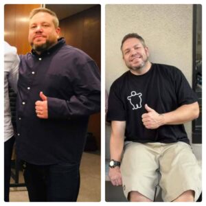 anthony transformation - before and after